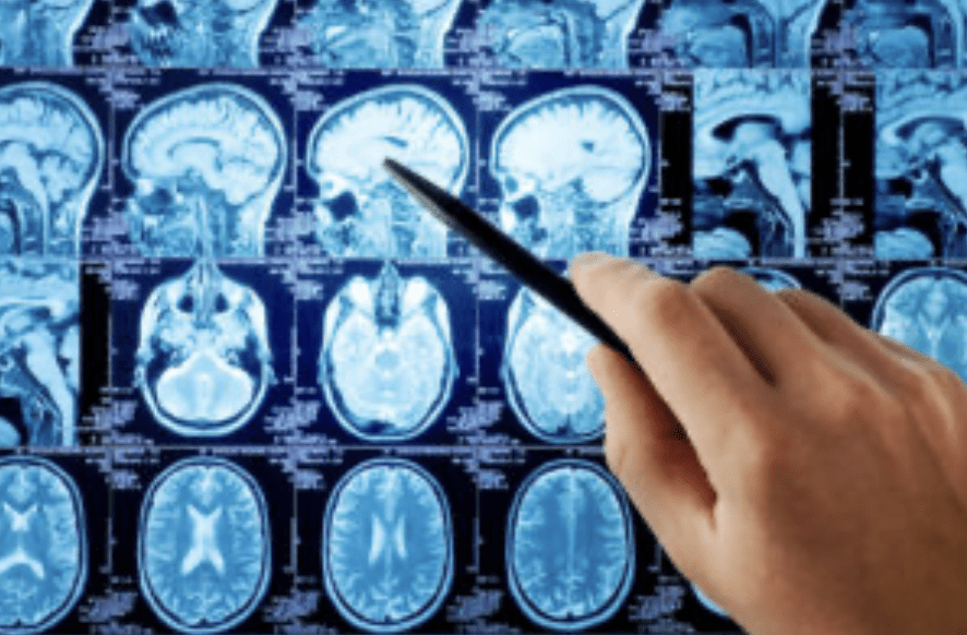 Donna O’Donnell Figurski Brain Injury